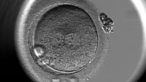 An embryo showing two pronuclei after fertilisation at Care Fertility