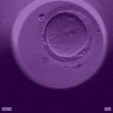 A GIF showing Caremaps Ai and how it creates an embryo.