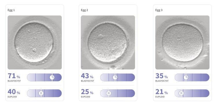 Violet AI sample report showing egg quality - available at Care Fertility as standard with all egg freezing packages.