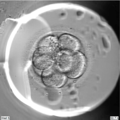 Microscope image of Heather and David's embryo developing during IVF treatment at Care Fertility.