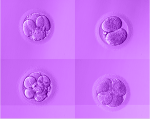 Microscope images of early-stage embryos analysed by AI to assess development patterns and predict IVF success potential