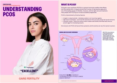 Care Fertility's guide to PCOS