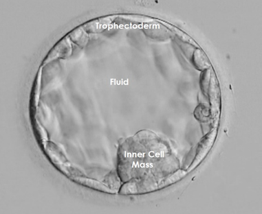 trophectoderm of the embryo